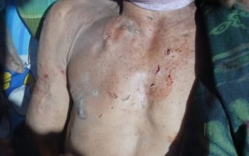 Tragis, Warga Pitumpanua Tewas Diterkam Buaya: Polisi Turun Tangan