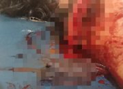 Pembacokan di Bungung Lompoa: Niat Damai Berujung Petaka, Korban Desak Polisi Bertindak Cepat